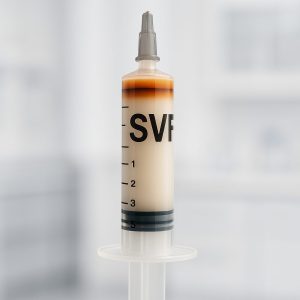 SVF