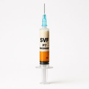 SVF