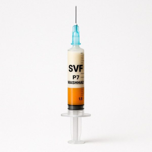 SVF
