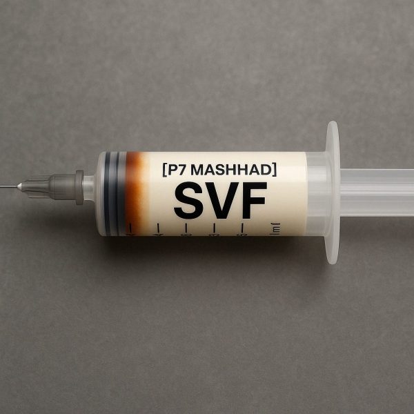 SVF