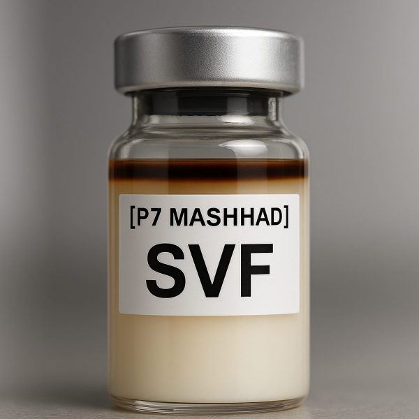 SVF